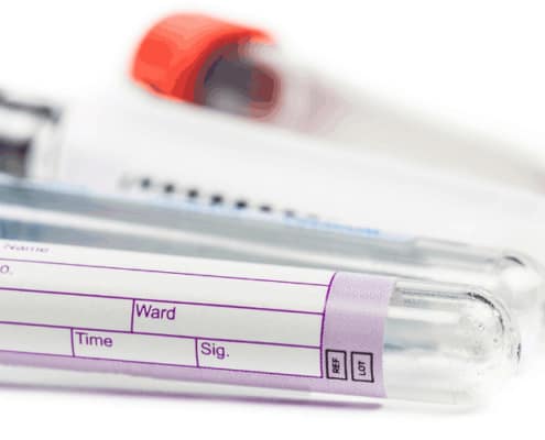 phlebotomy specialty tubes