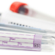 phlebotomy specialty tubes