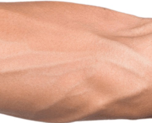how to anchor the vein