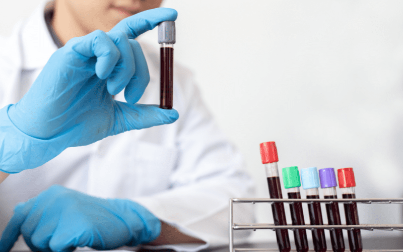 which blood test require fasting