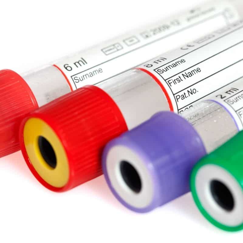 Test Tube Blood Types at James Barnhart blog