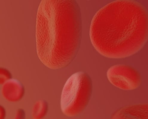 What is Therapeutic Phlebotomy?